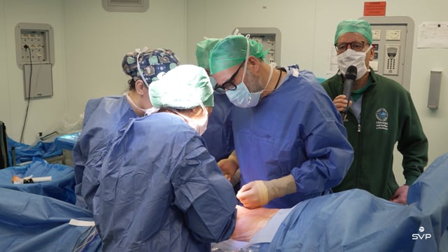 Gastrectomia subtotale con linfoadenectomia D2 - Verona - Palazzini 2025