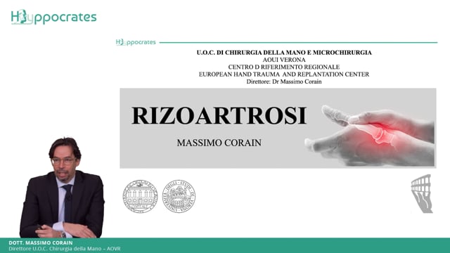 Rizoartrosi - Massimo Corain