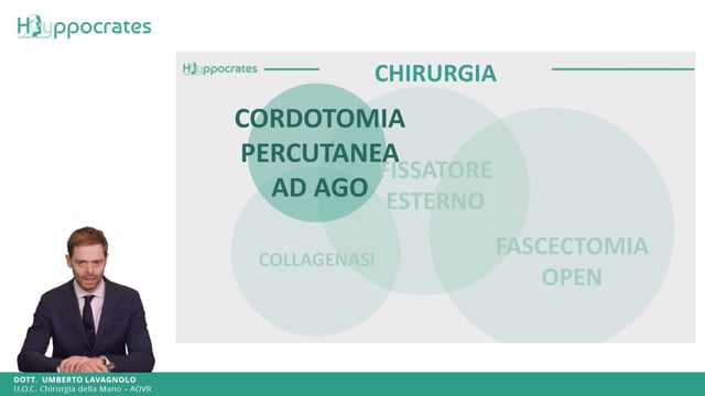 Il morbo di Dupuytren. Cordotomia percutanea ad ago - Alberto Garofano, Umberto Lavagnolo