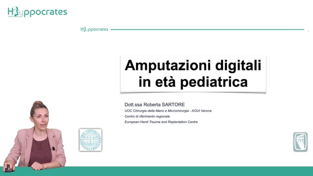 Amputazioni digitali in età pediatrica - Roberta Sartore