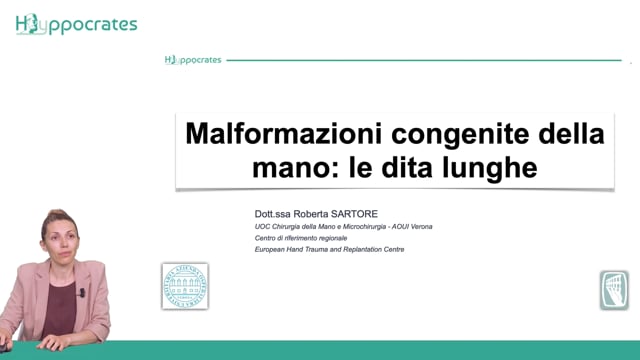 Malformazioni congenite della mano. Le dita lunghe - Roberta Sartore