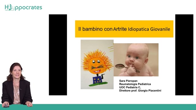 Il bambino con artrite idiopatica giovanile - Sara Pieropan